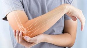 Elbow