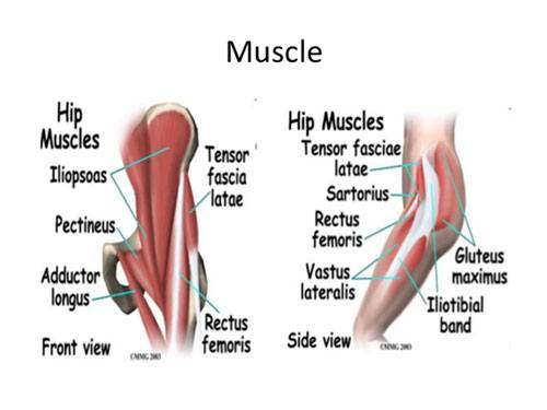 Hip Osteoarthritis