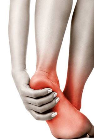 Plantar Fasciitis
