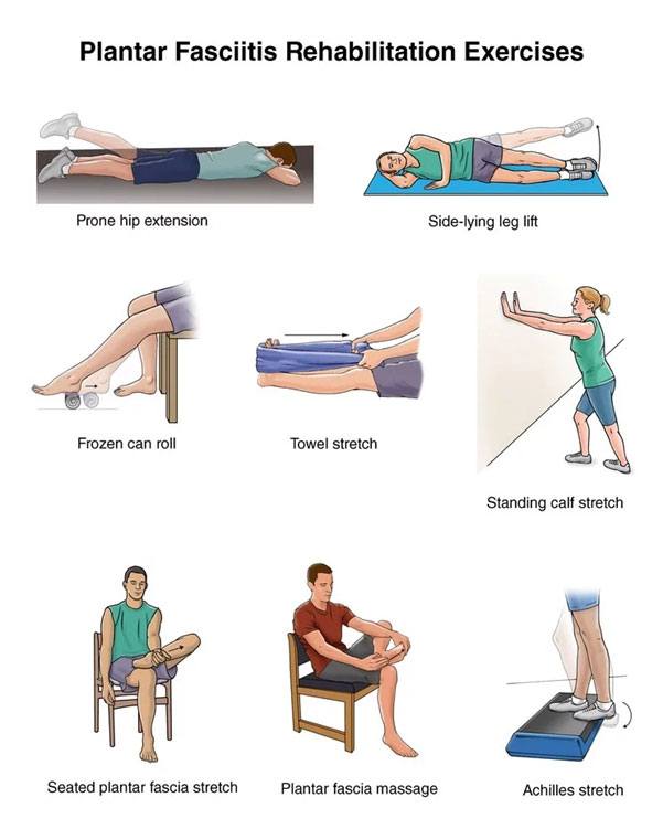 Plantar Fasciitis