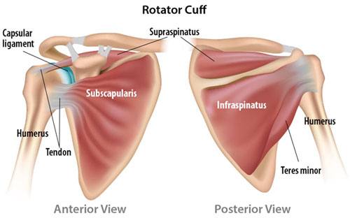 Rotator Cuff Tear