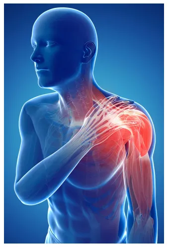 shoulder 1 pic