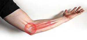 Tennis & Golfer’s Elbow